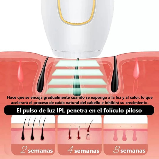 DEPILADORA LASER IPL