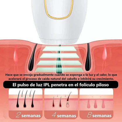 DEPILADORA LASER IPL